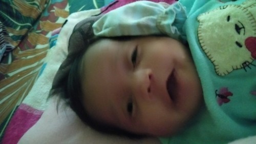 Mencari solusi untuk Kulit bayi yang terkena asi