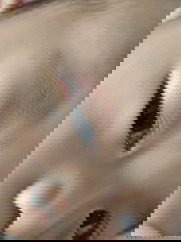 ขอคำแนะนำในการดูแลเบื้องต้น