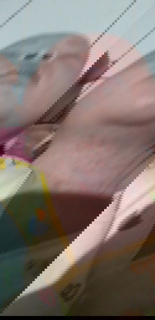 Newborn ruam di leher