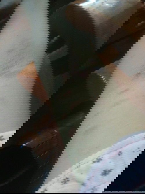 Bầu 35w mà cứ bị ngứa như này thôi các mom cho em hỏi mik ăn uống có cần phải kiên gì ko vy