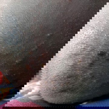 Kepala bintik2 kaya nanah