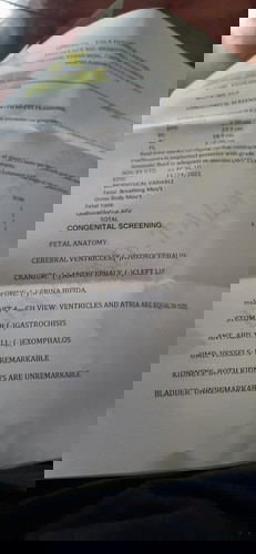 hello po mga sis pabasa nman po ako ng result sa mrunong sa 28 pa po kasi blik ko sa ob ko. slamat🥰