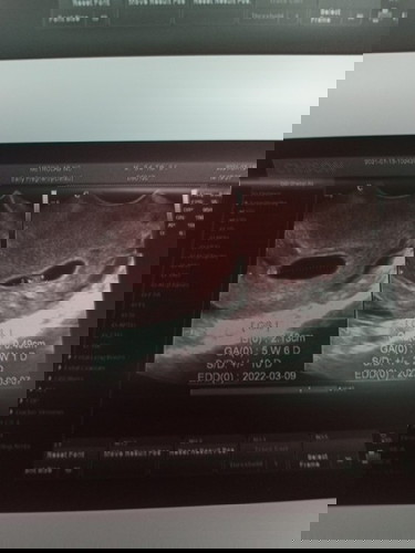 Maselan na Paglilihi