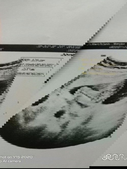 อยากทราบเพศน้องคะแม่ๆช่วยดูหน่อยว่าหญิงหรือชายขอบคุณสำหรับคำตอบคะ