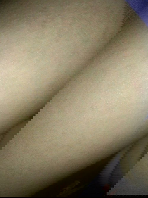 มีใครเคยเป็นแบบนี้บ้างคะ