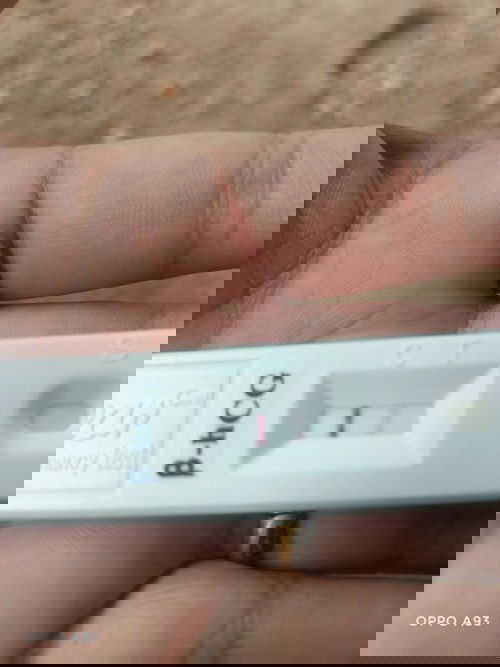 เบาหวานก่อนท้อง