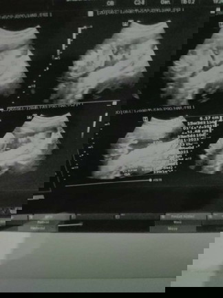 แม่ๆช่วยดูหน่อยค่ะหน้าน้องอยู่ตรงไหนน