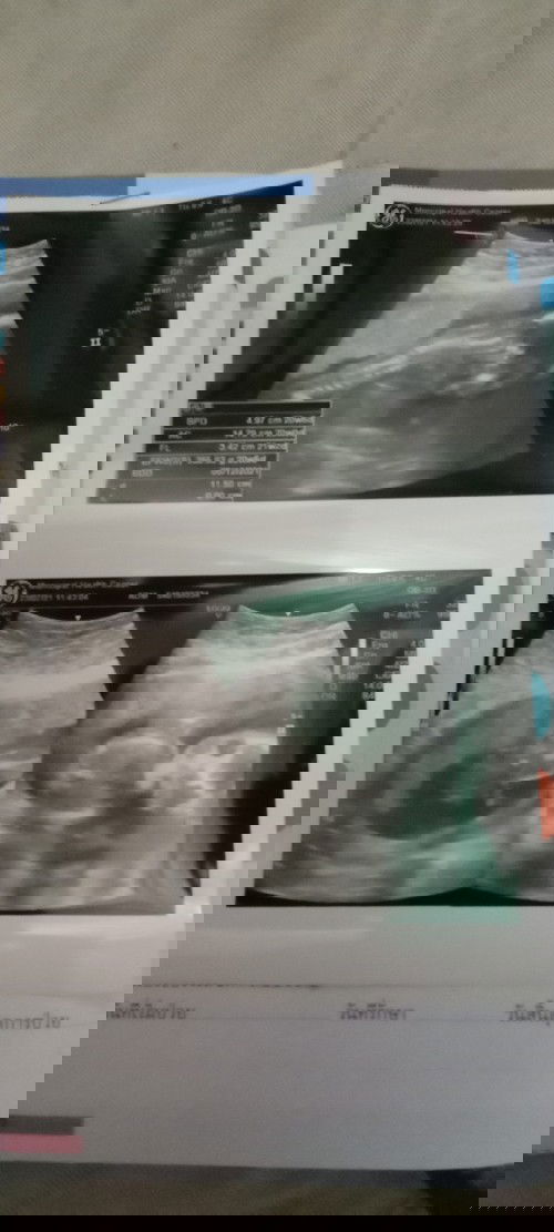 ได้ลูกชายจ้าาา