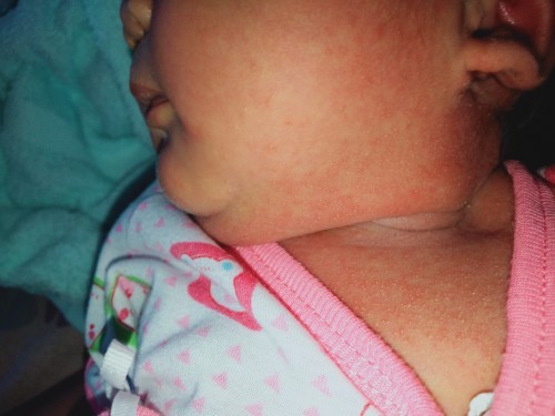 สอบถามแม่ๆที่คลอดแล้วหน่อยค่ะ