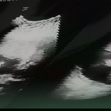 โชว์แต่หน้า...เลยไม่รู้เลย ผญ/ผช