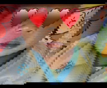 Putih putih diwajah baby