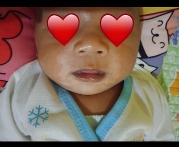 Putih putih diwajah baby