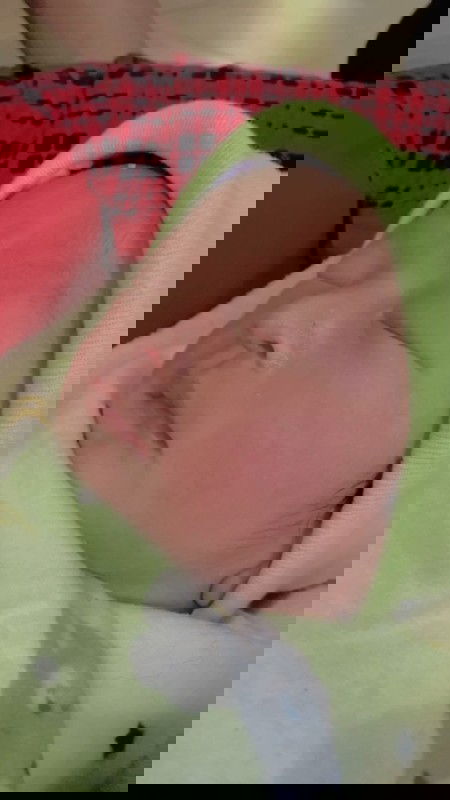 Lahiran di 38week4day tanpa Jahitan