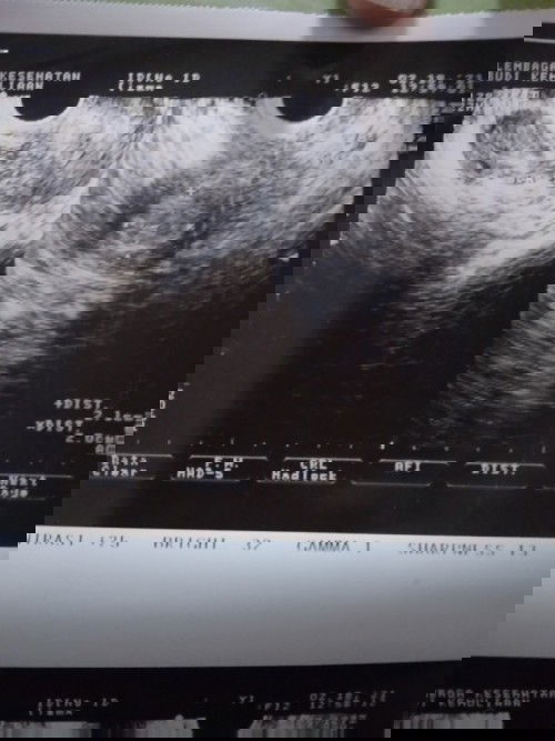 Berpisah sebelum berjumpa