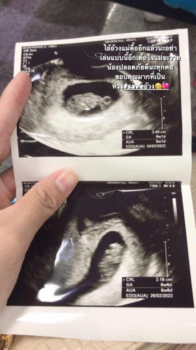 9week ท้องแรก💖