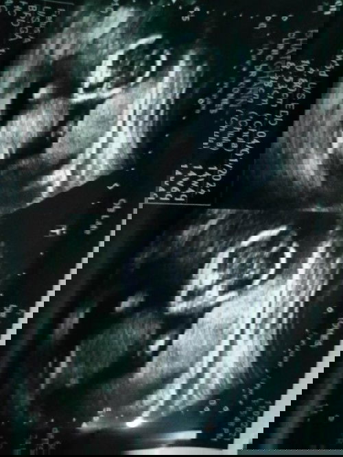 ภาพอัลตร้าซาวด์