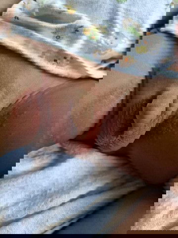 ขาหนีบแดงครับ