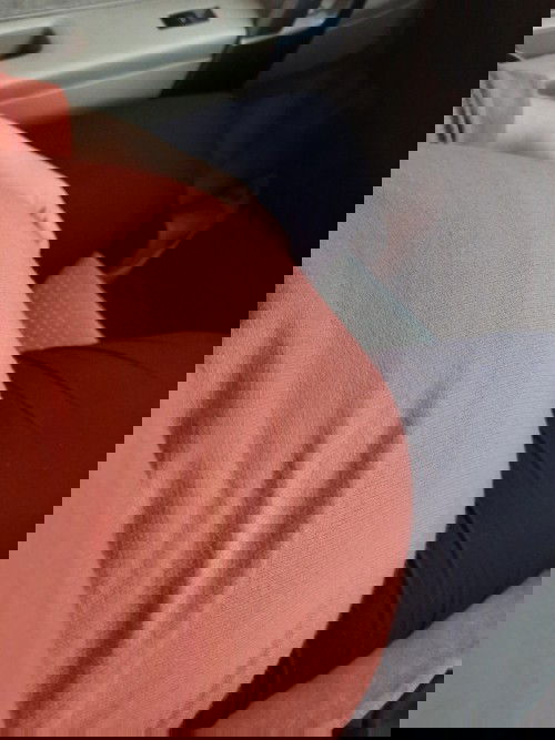 Bayi sungsang dan terlilit tali pusar di usia 34week