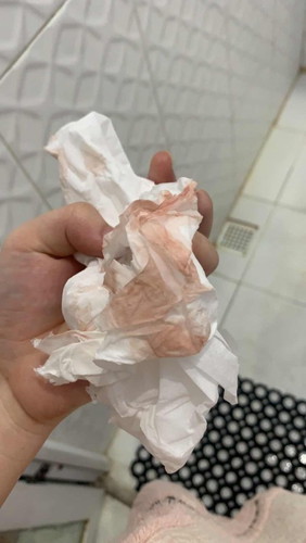 Perut mulas dan keluar lendir coklat kemerahan