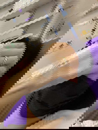 สรุปว่าท้องนอกมดลูก