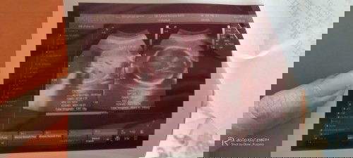 Baby blm masuk panggul