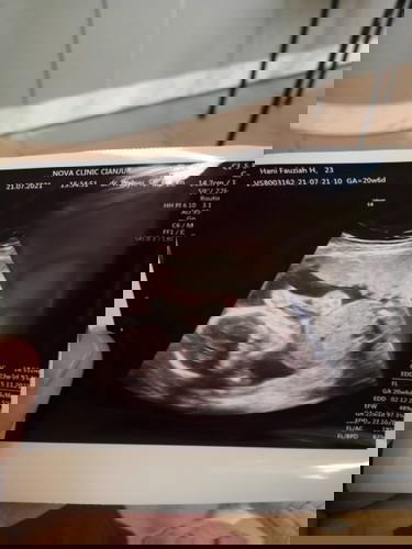 Mencari inspirasi nama anak perempuan