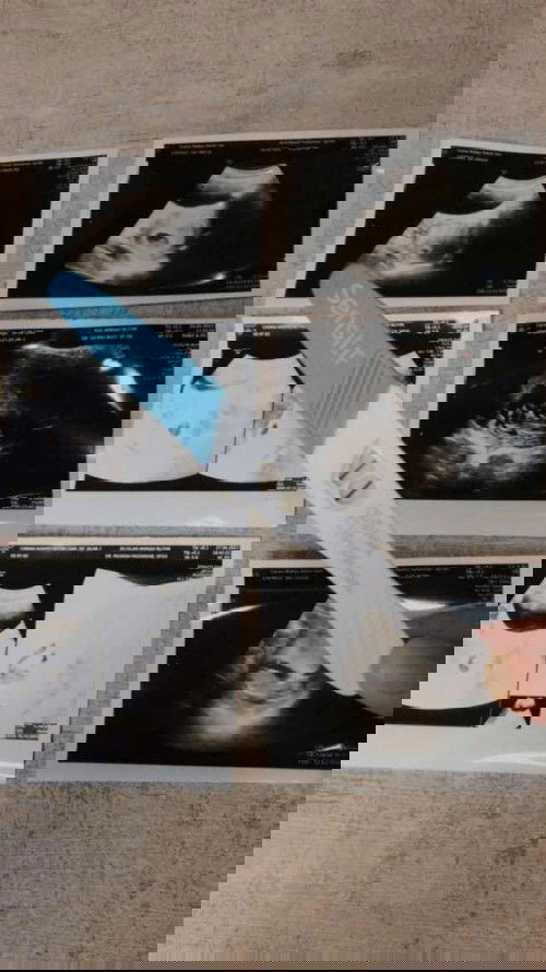 KISTA BUKAN PENGHALANG BAGI KAMI UNTUK MENDAPAT MOMONGAN