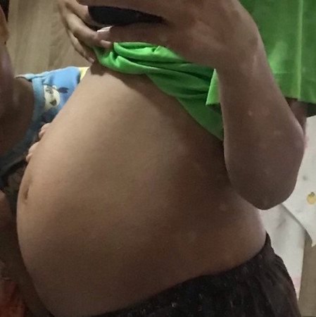 เป็นคนผอม 19w3d ท้องเล็กมั้ยค่ะ