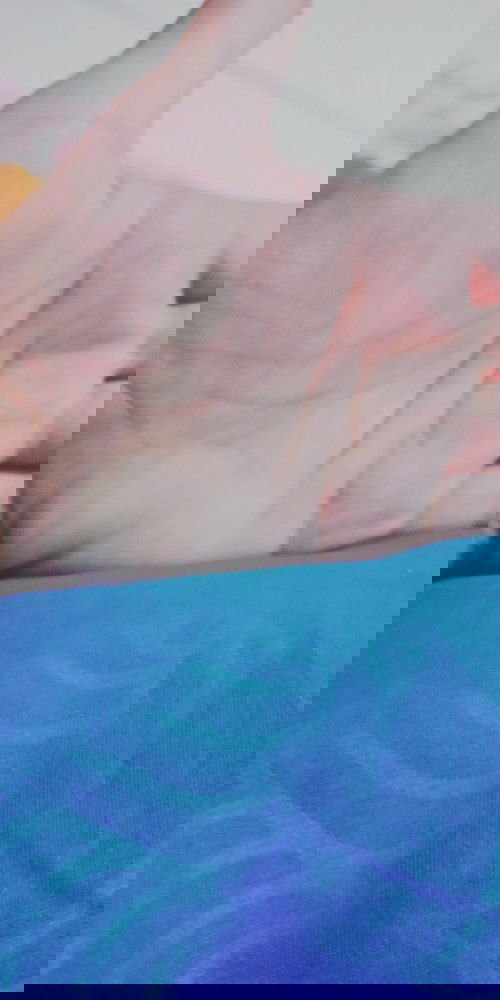 Gatal di telapak tangan dan kaki