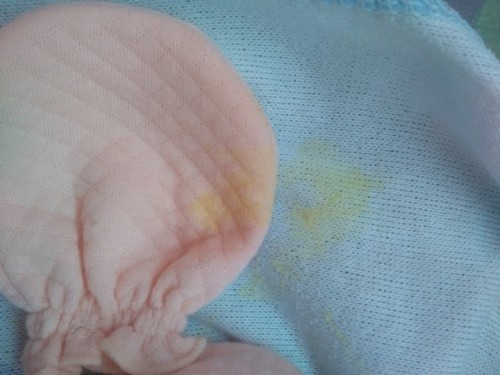 น้องได้8วัน แหวะเป็นสีเหลือง เป็นอะไหมค่ะ
แล้วมีใครเคยเป็นไหมคะ