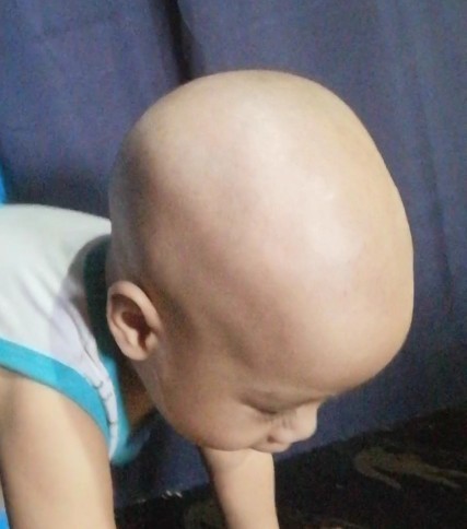 Baby's head