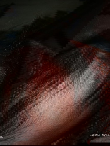 Benjolan di kepala bayi