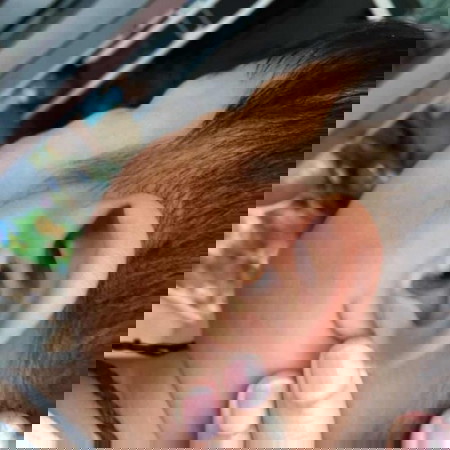 ลูกรูข้างหูอักเสบ