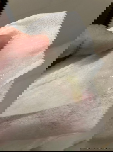 อายุครรภ์38สัปดาห์พอดีมีมูกใสๆมาช่วงกลางคืนแบบนี้