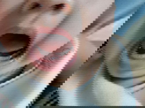 Mọc răng lúc 3m25d?