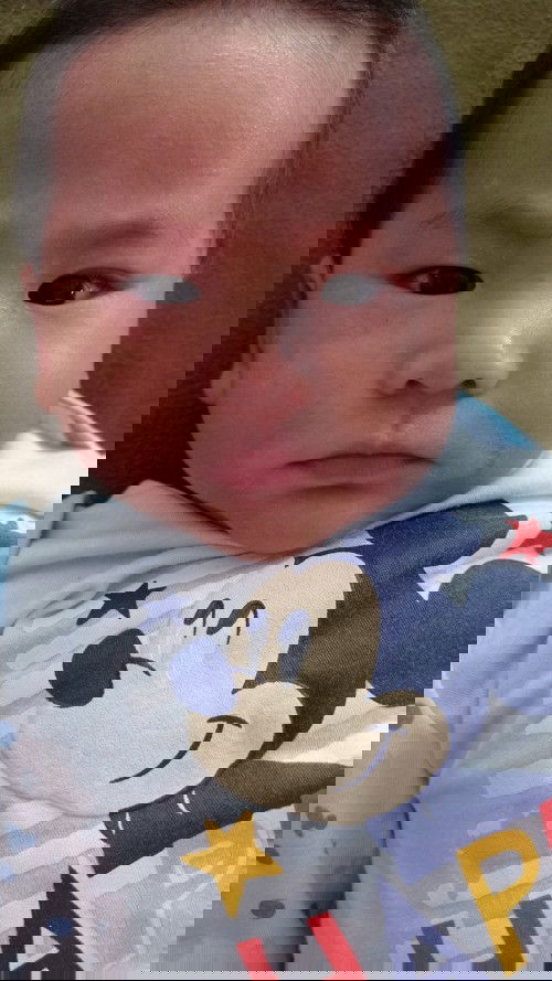 ลูกชาย 3 เดือน ผิวหน้าแห้ง 😓