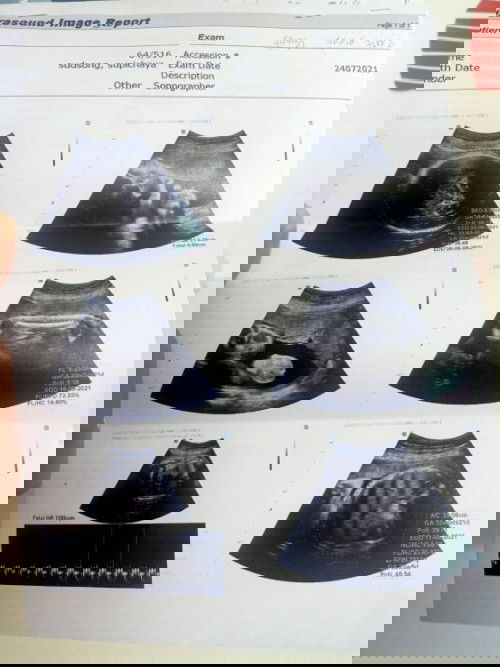 น้ำหนักเยอะไปไหม 2.6 Kg