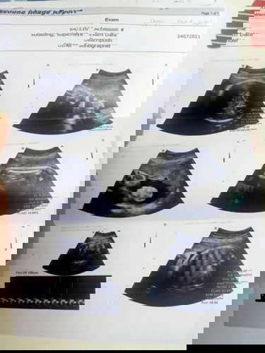 น้ำหนักเยอะไปไหม 2.6 Kg