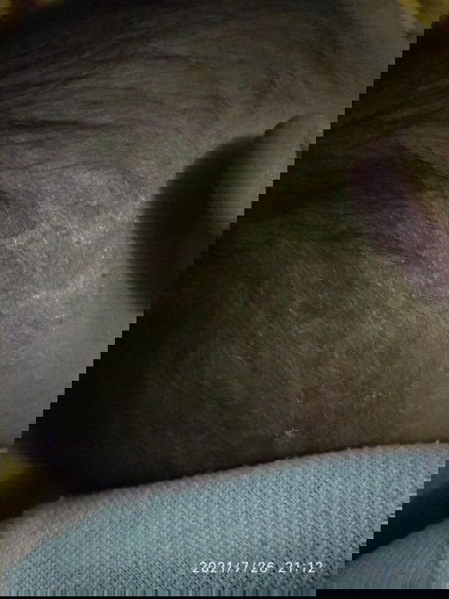 Kulit kepala kering bayi 8 bulan