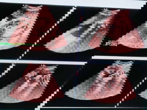 Bun nanya dung yg udah 7 bulan ,