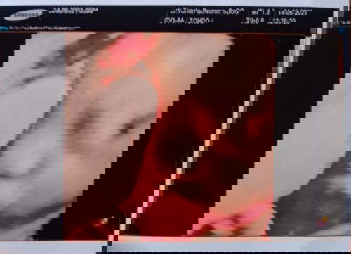 Hayo Cwek apa Cwok nih? Kata Dokter Cwok tp di Gender ditulis Female,soalnya pas USG doi tengkurep😁