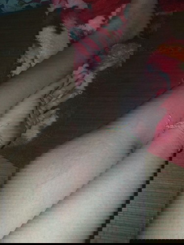 Có m nào bị nổi dị ứng rồi chân tay phù lên không ạ? Ai có cách trị hôk chỉ e với ạ