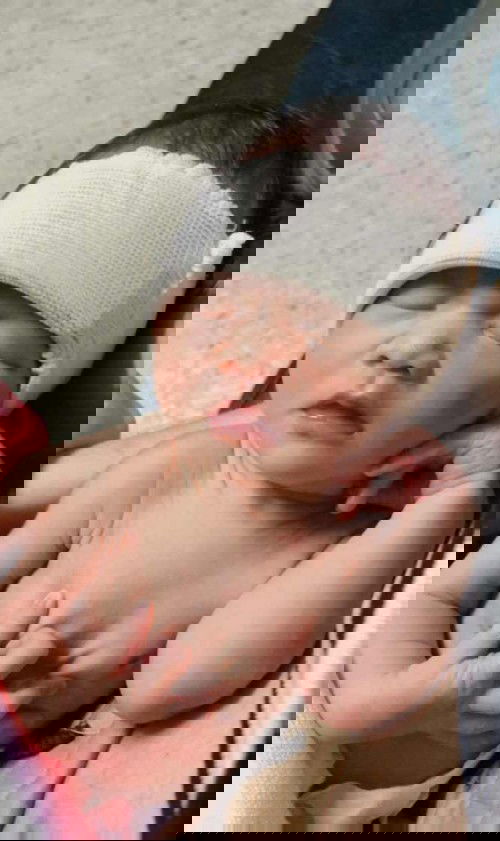 คลอดก่อนกำหนดคลอดตอน36สัปดาห์