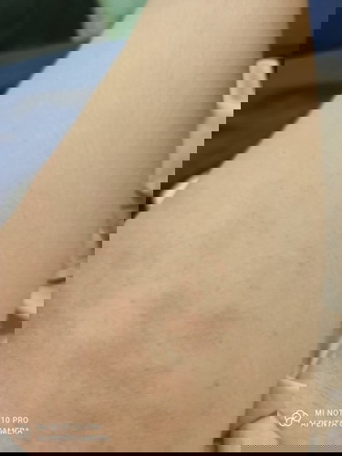 Rushes
19weeks pregnant