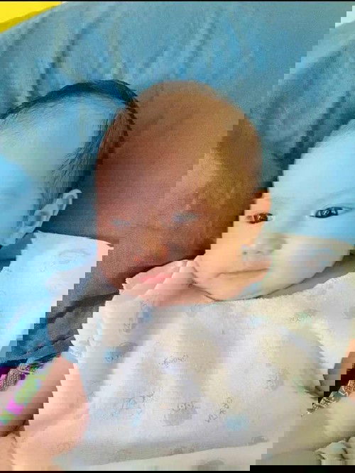 คุณแม่ผ่าคลอด คุณแม่ให้นม #มาประจำเดือนกันตอนไหนคะ❓