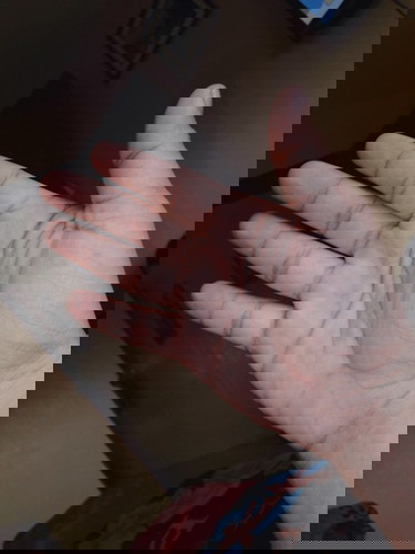 Normal po ba sa buntis ang sumakit ang kamay at pag ka manhid nito halos mag iisang buwan napo.