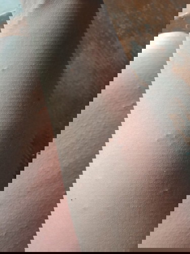 ต้ังครรภ์.