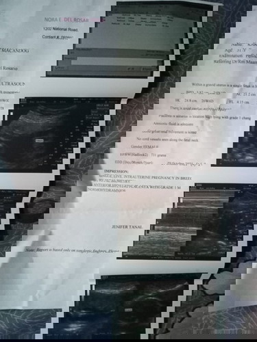 Girl po ba talaga to