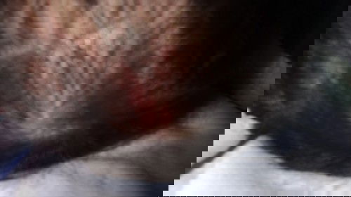 Salep buat ruam di kepala bayi