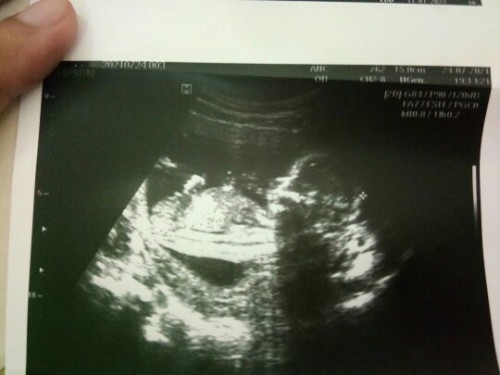 ทีมธันวา64